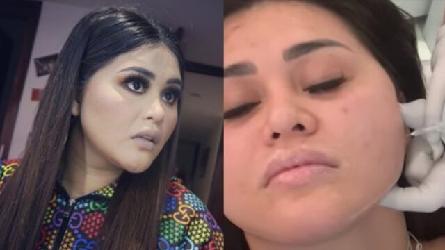 Gomita asÃ­ luce ahora despuÃ©s arreglos cara: Aracely Ordaz
