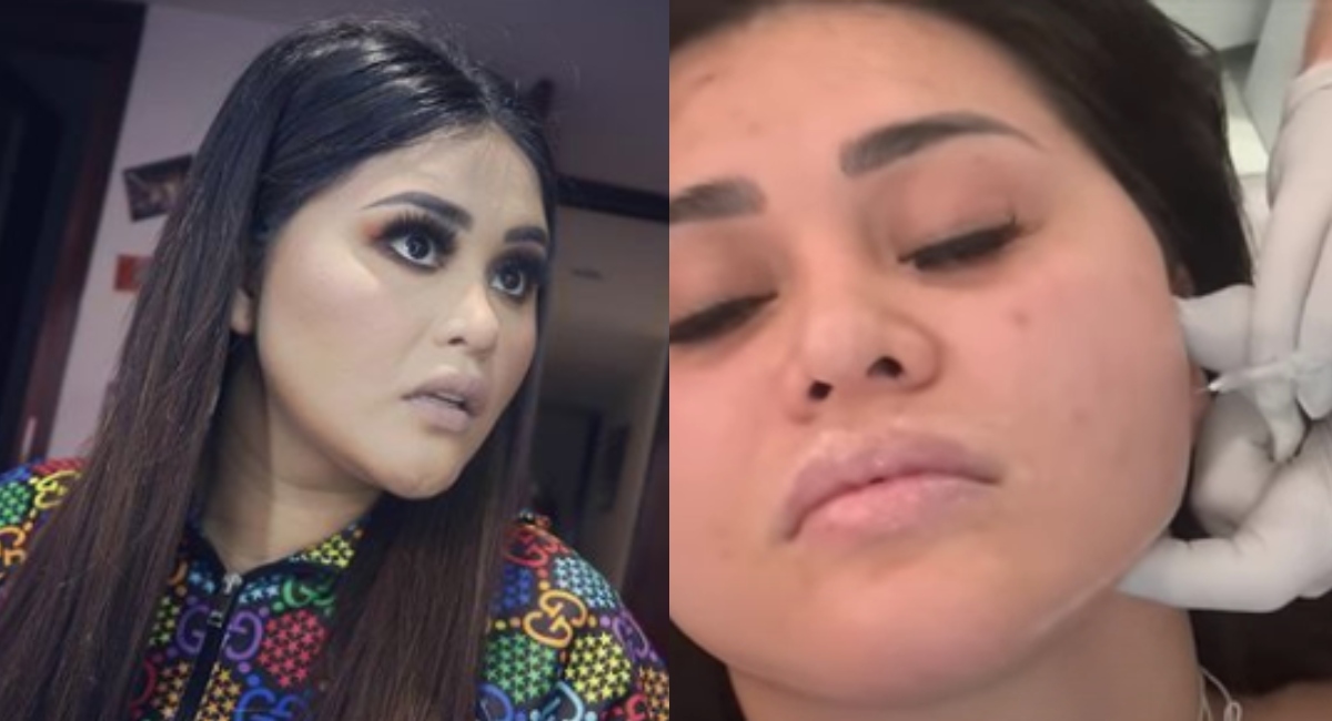Gomita así luce ahora después arreglos cara: Aracely Ordaz