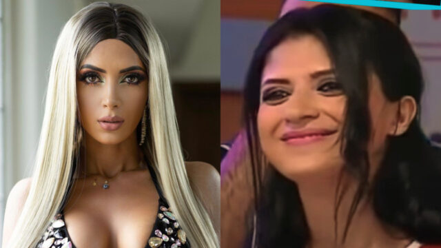 Kimberly Flores antes y despues de cirugÃ­as revelan fotos