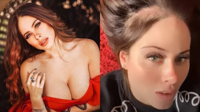 Nacha de Acapulco Shore muestra resultados de su alopecia