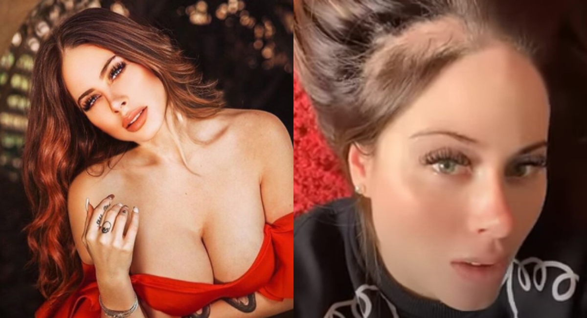 Nacha de Acapulco Shore muestra resultados de su alopecia