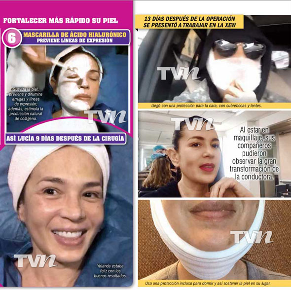 Yolanda Andrade se sometió cirugías cambiaron cara