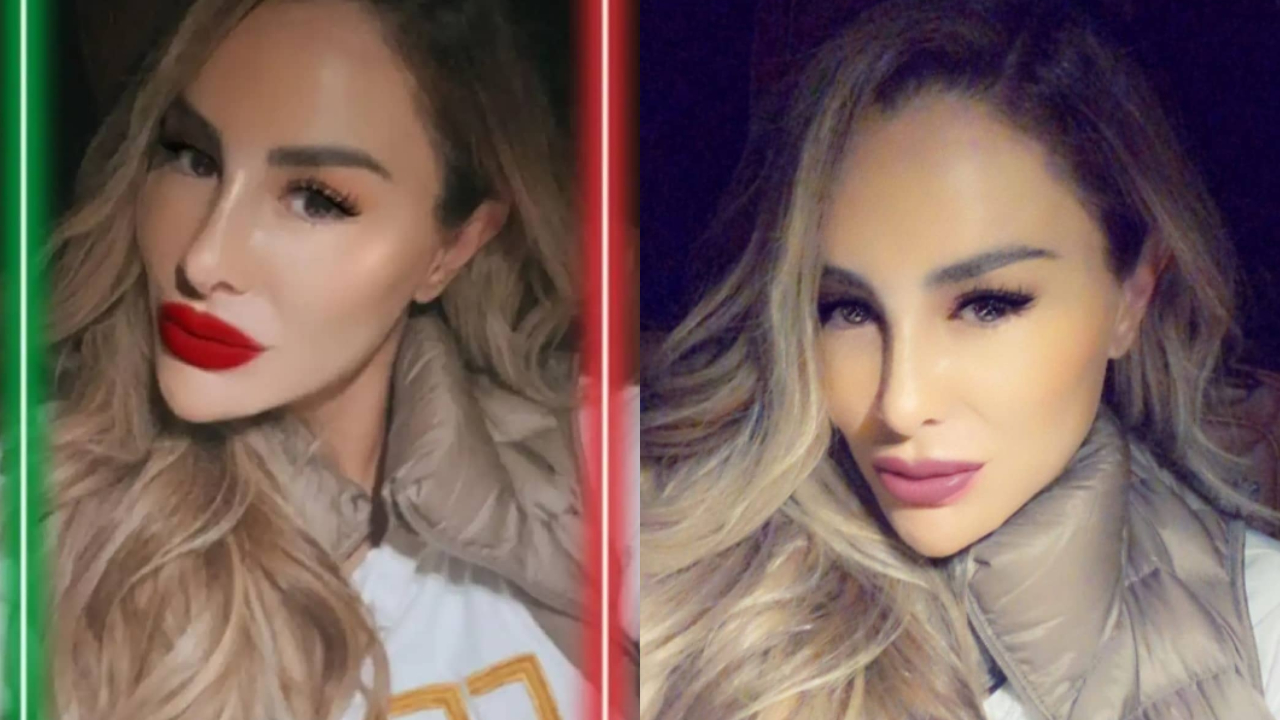 Ninel Conde nueva cirugÃ­a