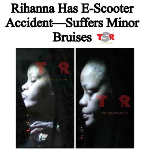 Rihanna sufrió con golpes en la cara en Los Angeles