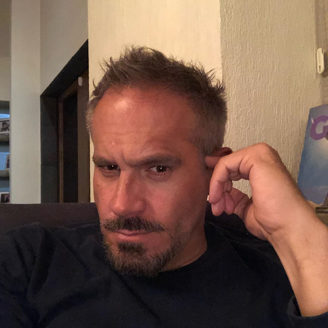 Arath de la Torre se hace tratamiento para rejuvenecer