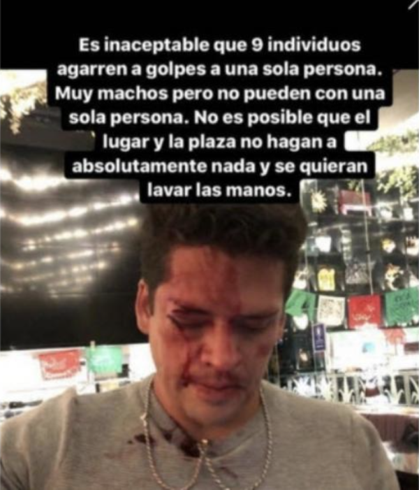 Acusan a Said P. y Brandon "Wapayaso" de golpear al primo de Eduardo Capetillo Jr.
