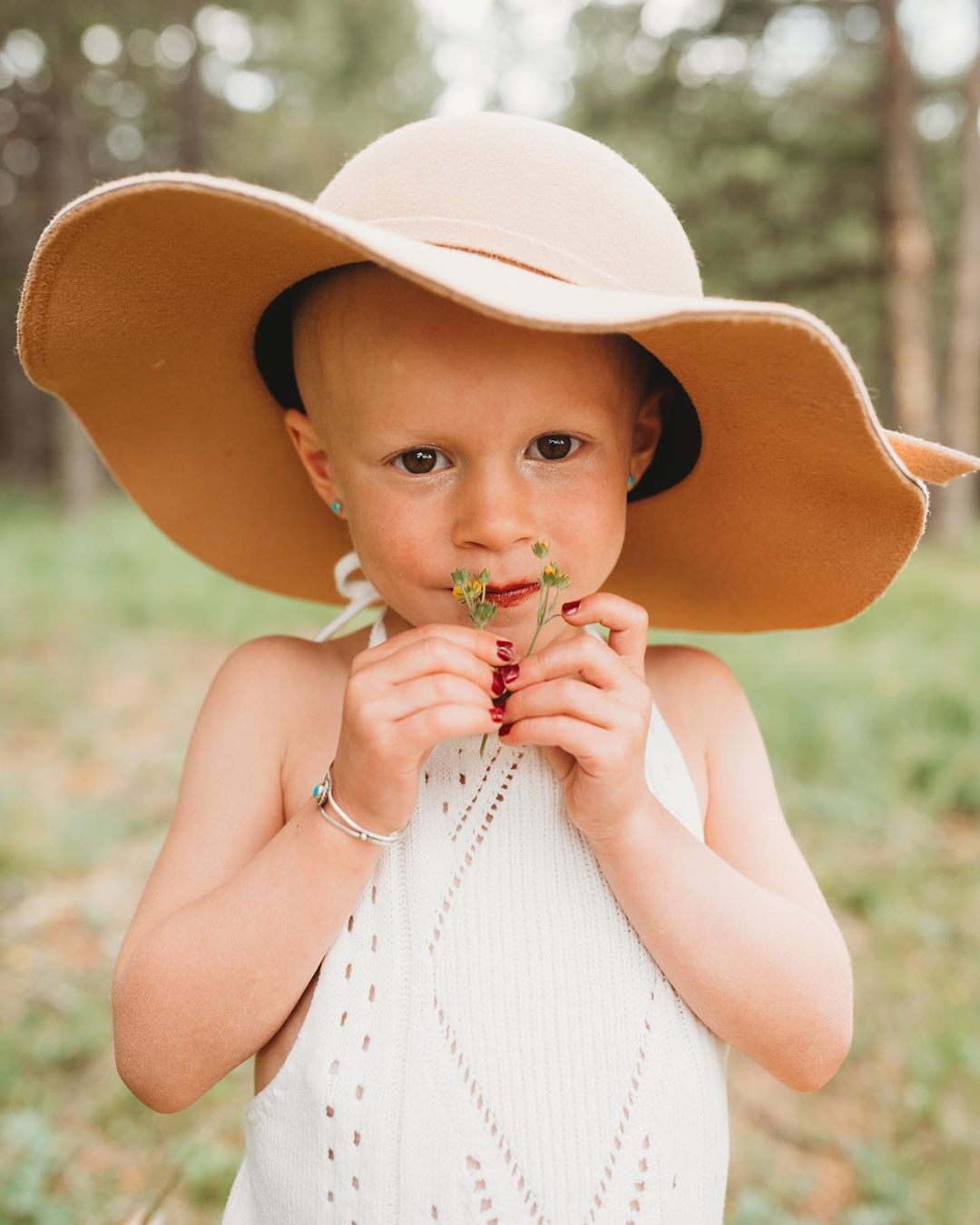 Niña celebra que venció el cáncer con una sesión de fotos para contar su historia