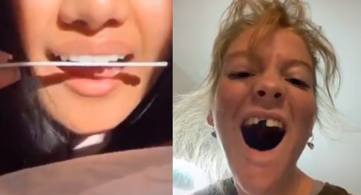 Personas se liman los dientes para emparejarlos por el nuevo reto de Tik Tok
