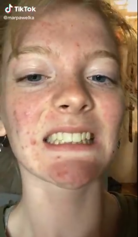 Personas se liman los dientes para emparejarlos por el nuevo reto de Tik Tok