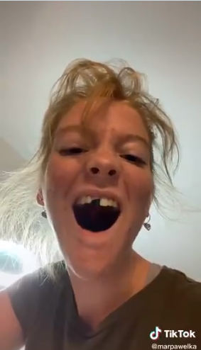 Personas se liman los dientes para emparejarlos por el nuevo reto de Tik Tok