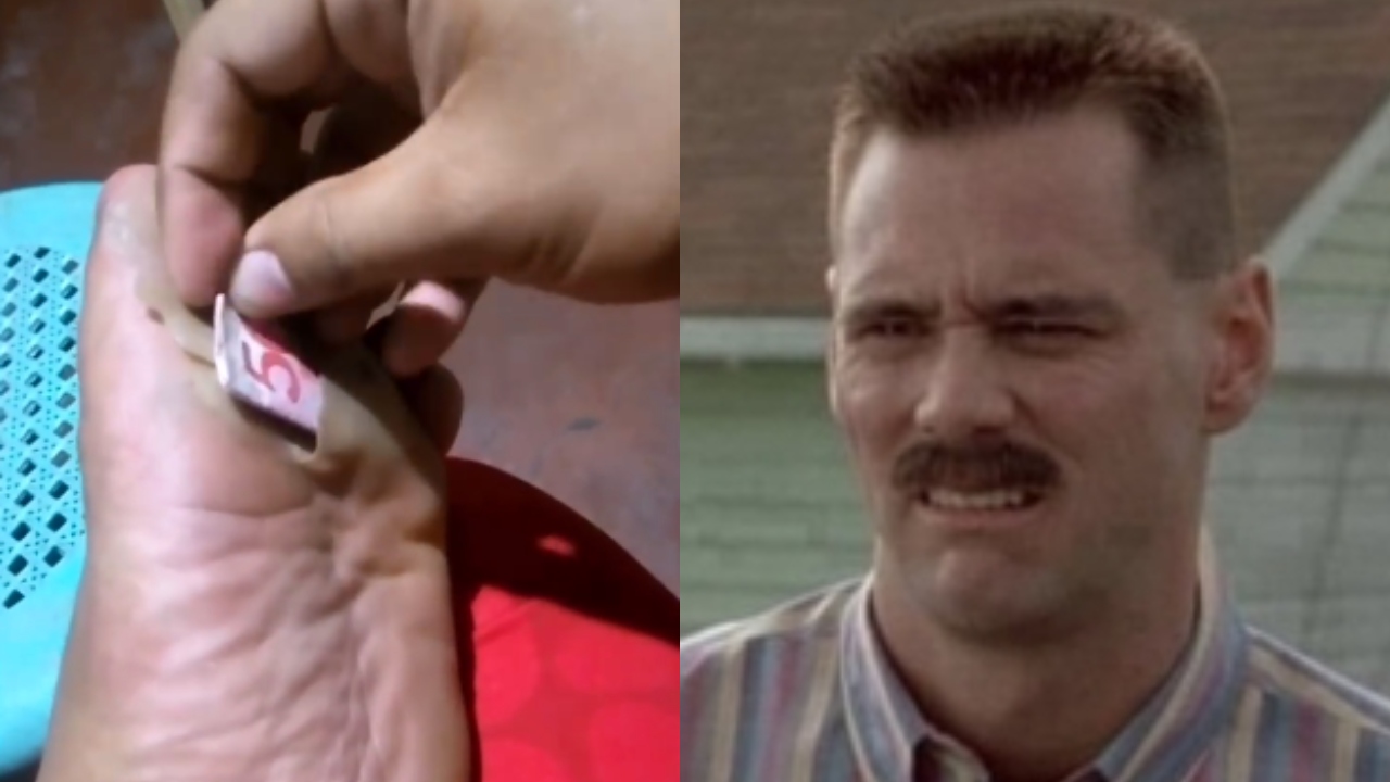 Hombra usa el callo de su pie como cartera