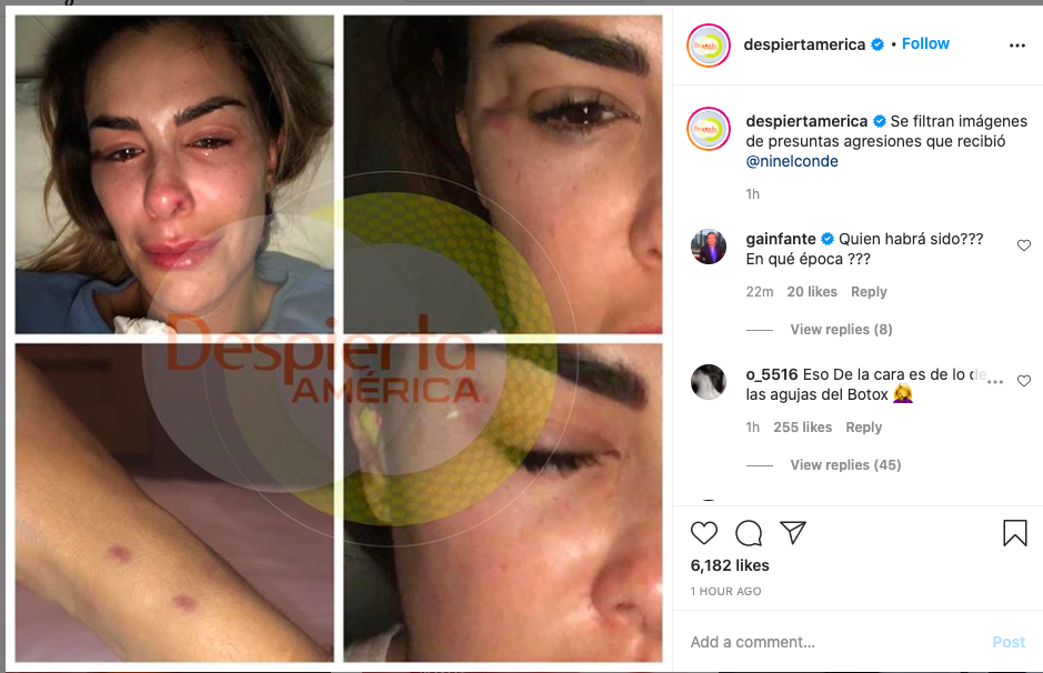 filtran fotos de ninel conde golpeada