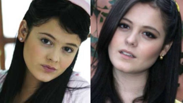 Allisson Lozz podría quedar ciega