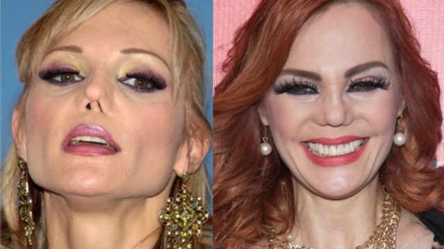 Carmen Campuzano perdió la nariz, no el olfato