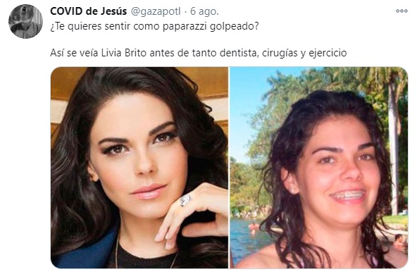 Livia brito antes de las cirugias