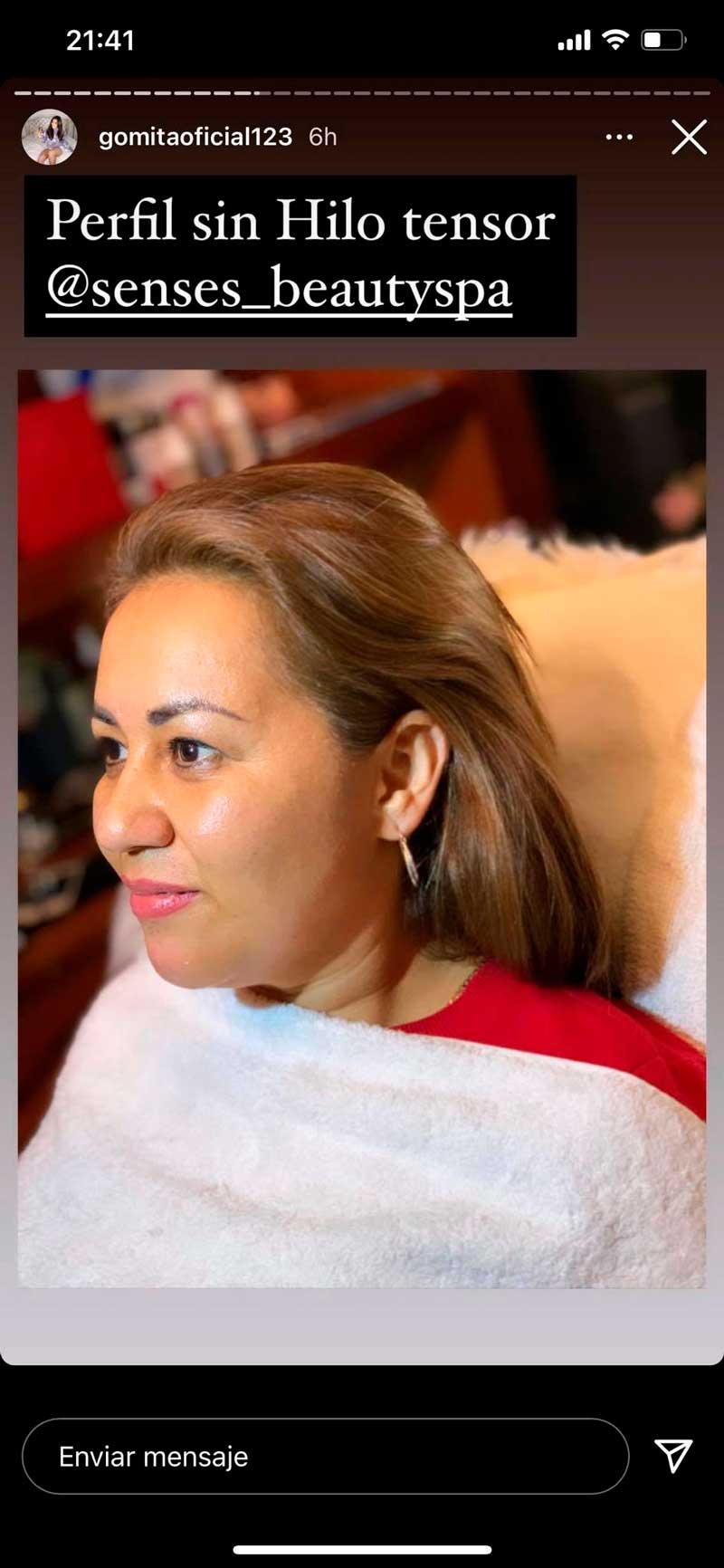 Mamá de Gomita antes de hacer arreglitos en el rostro