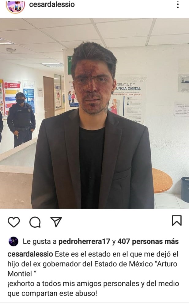 César D'Alessio, hijo de Lupita D'Alessio, denuncia que fue golpeado por el hijo de Arturo Montiel