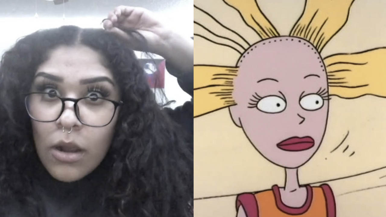 El reto viral del "Scalp Popping" en TikTok resultÃ³ ser peligroso de hacer