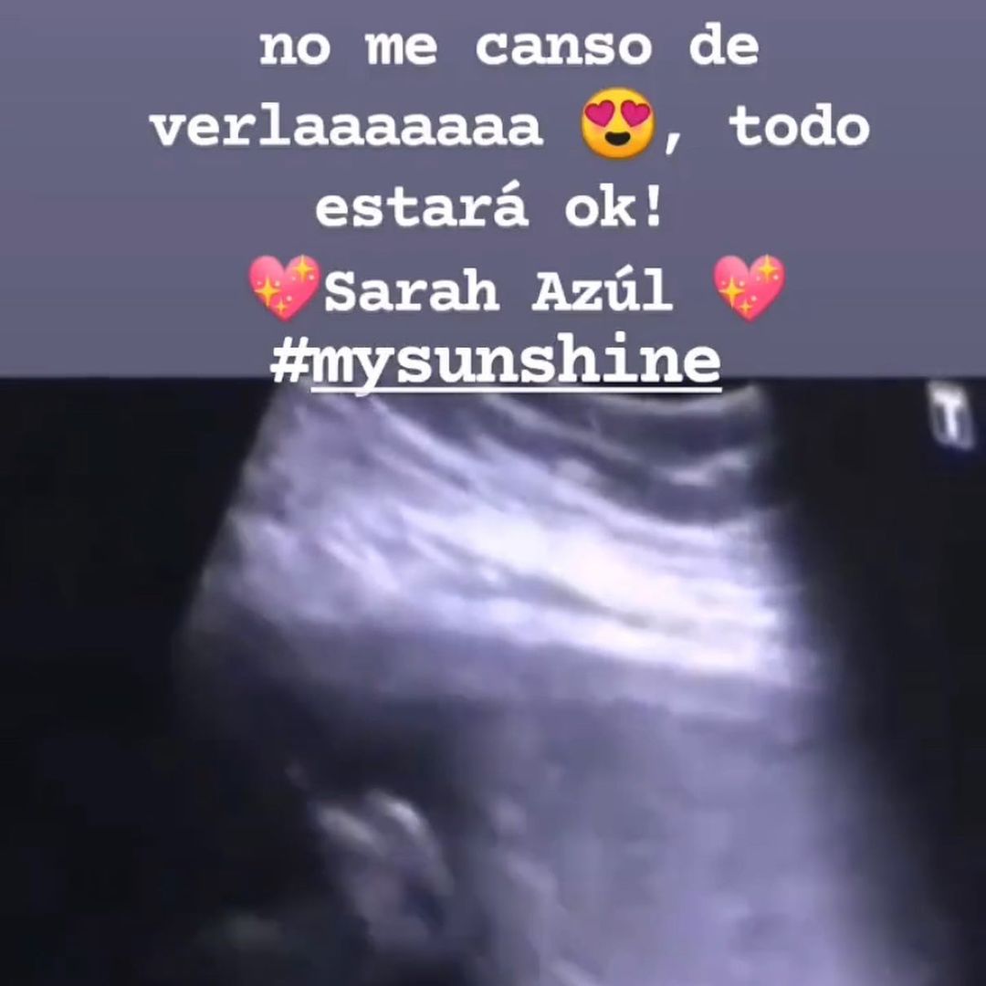 Ultrasonido cristian castro papá