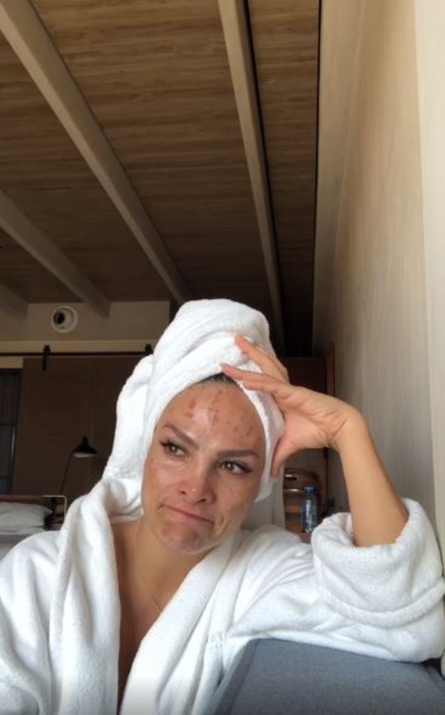 Fabiola Campomanes sufrió lesiones en la cara tras obsesionarse con tratamientos estéticos