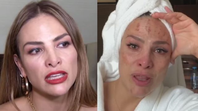 Fabiola Campomanes muestra las lesiones que sufrió en la cara