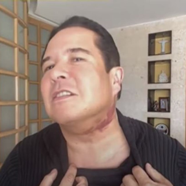 Gustavo adolfo infante con moretones en el cuello