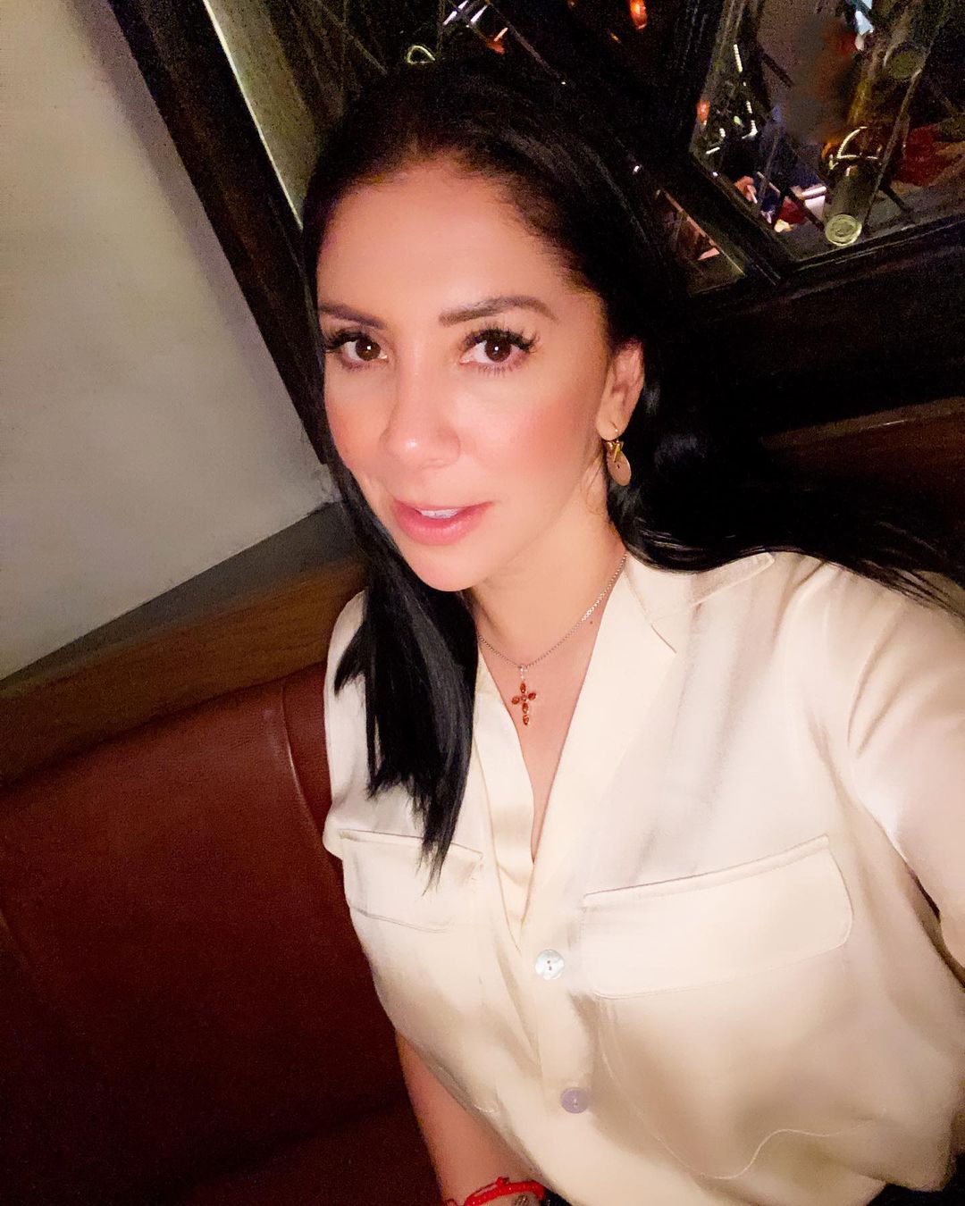 Karina Ortegón muestra fotos de los golpes que le dio Vicente Fernández Jr