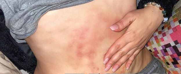 Fotos de los golpes de Karina Ortegón por Vicente Fernández Jr