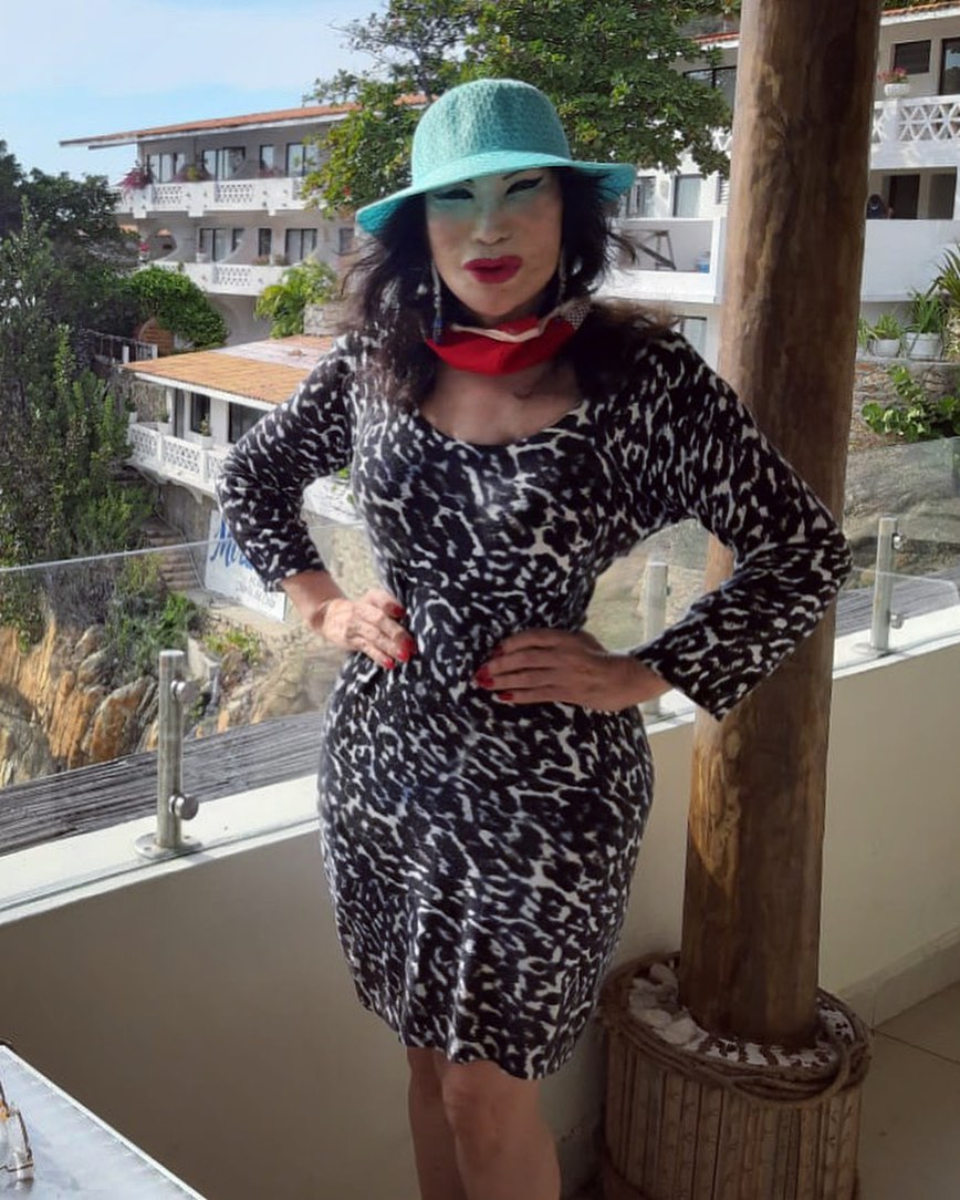 La vedette Lyn May a sus 69 años de edad