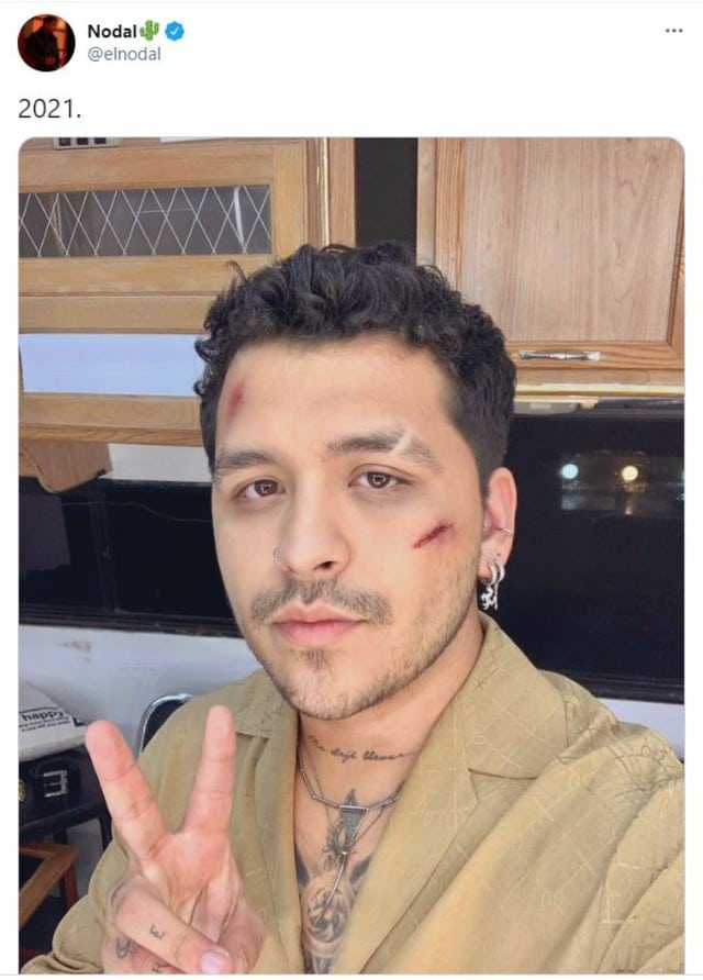 Christian Nodal reaparece con golpes en la cara