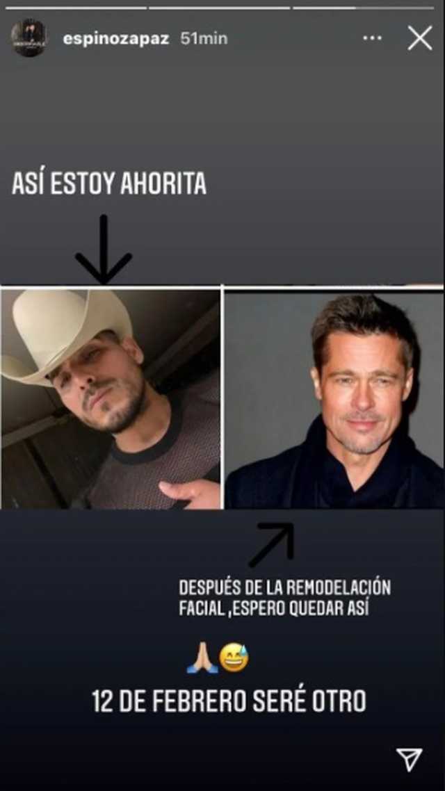 Espinoza Paz quiere quedar como Brad Pitt con cirugía