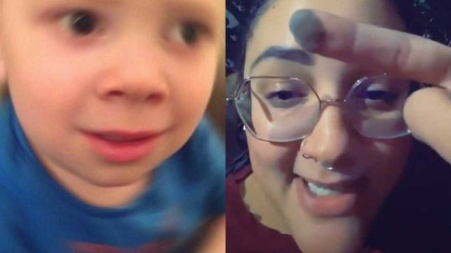Mujer muestra que le crece vello púbico en el dedo por injerto de piel
