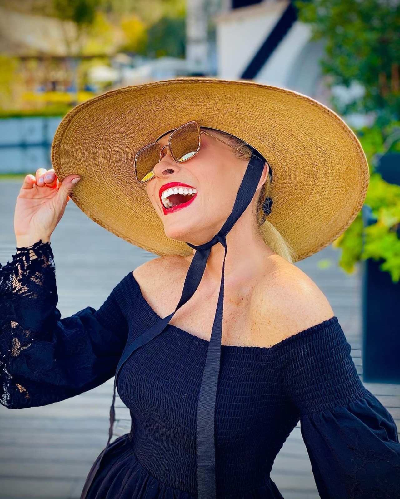 Yuri usa sombrero para ocultar su alopecia