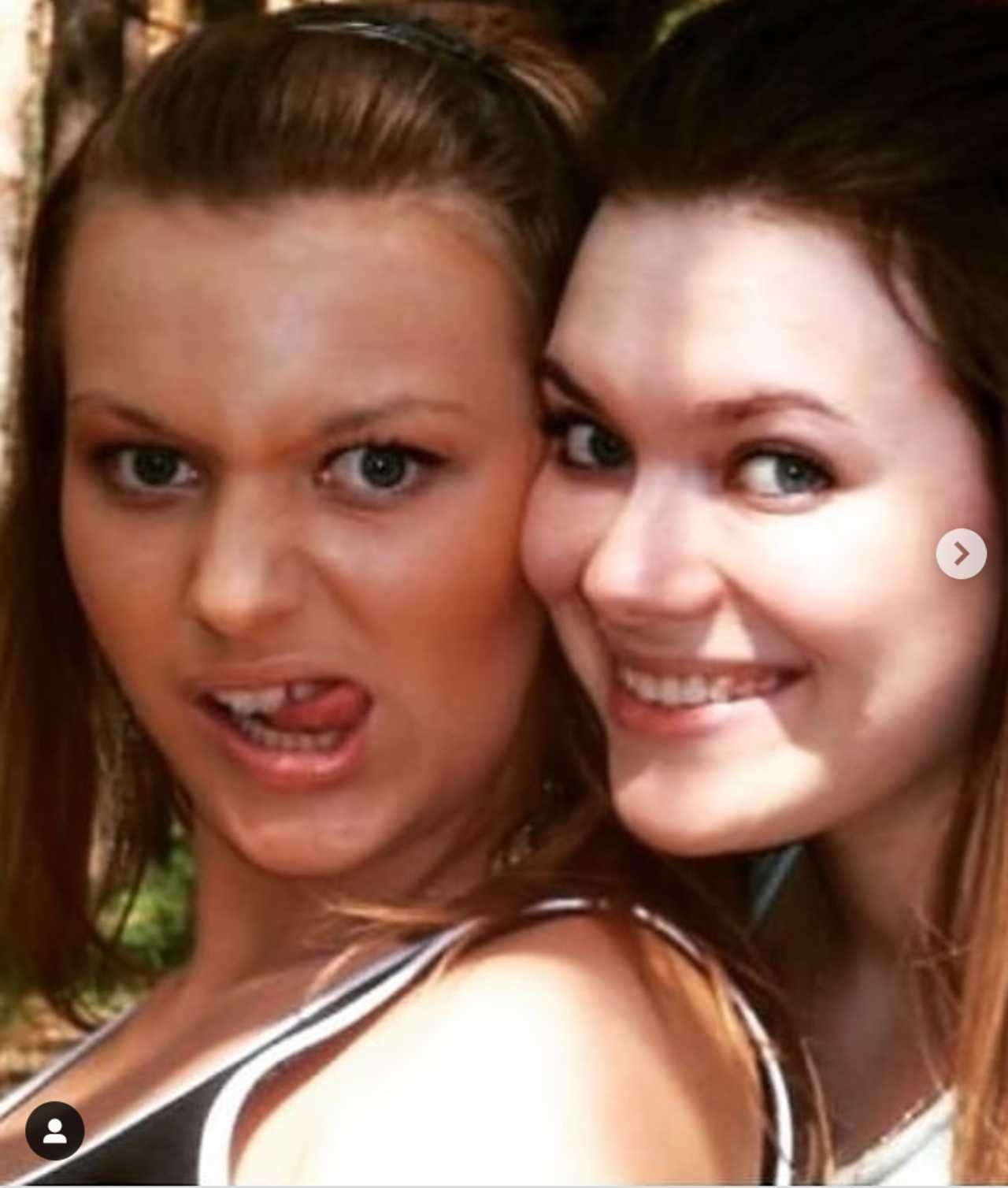 Irina Baeva en la adolescencia antes de operarse