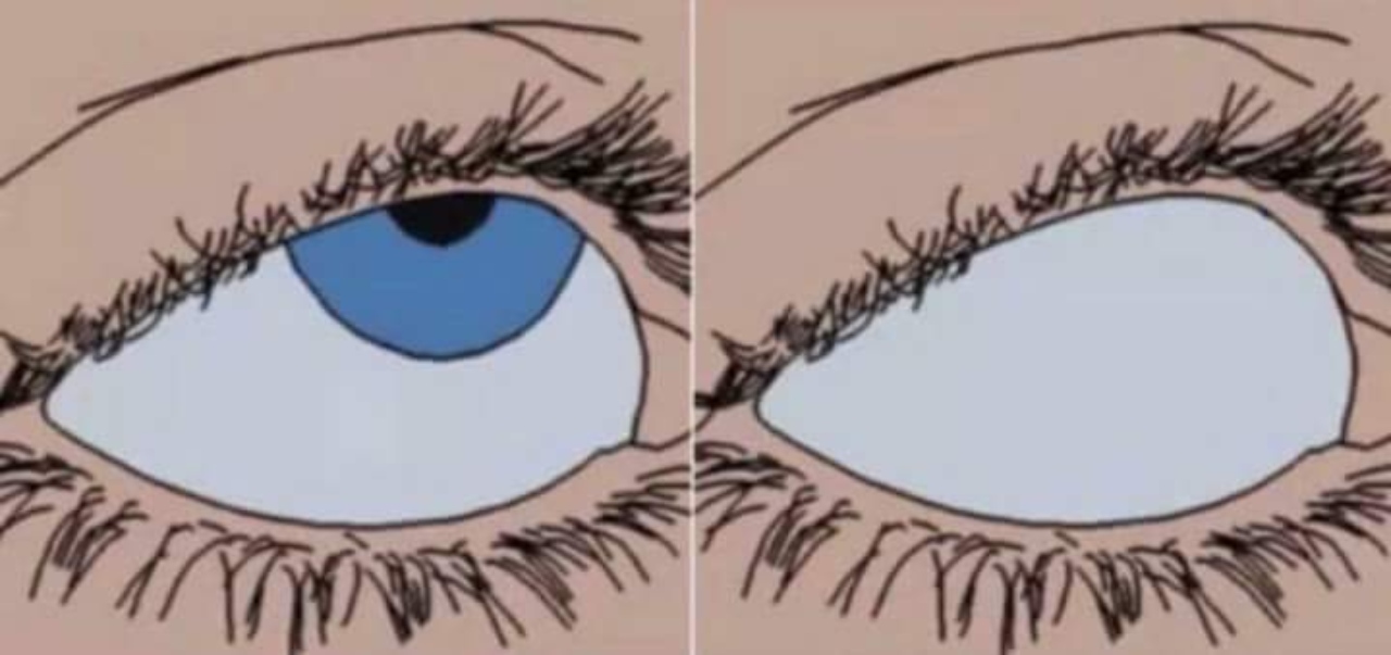 Ojos para arriba meme