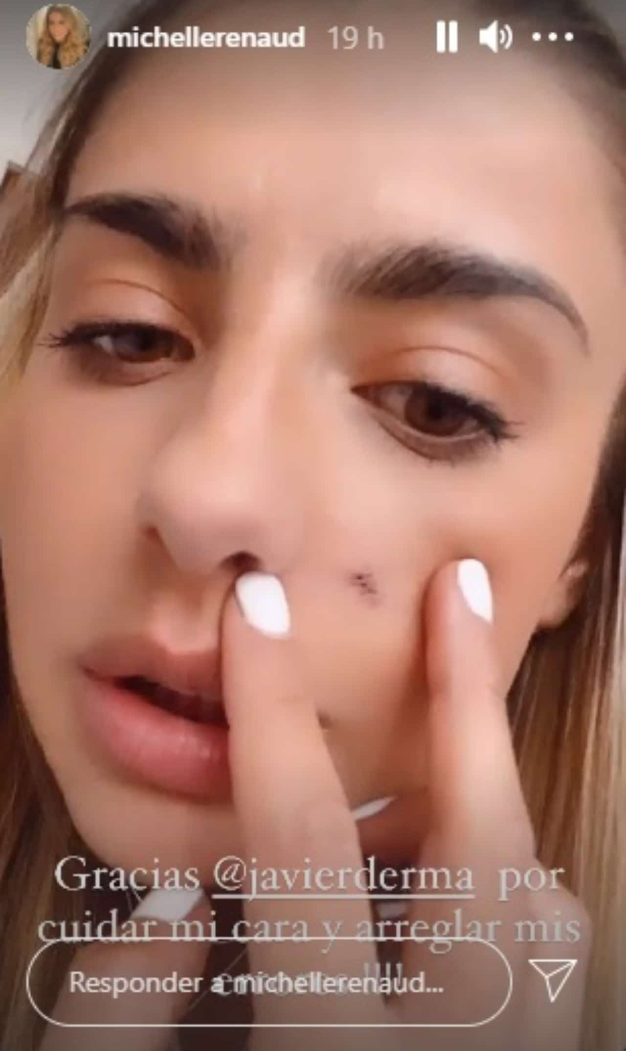 Michelle Renaud con herida en la cara
