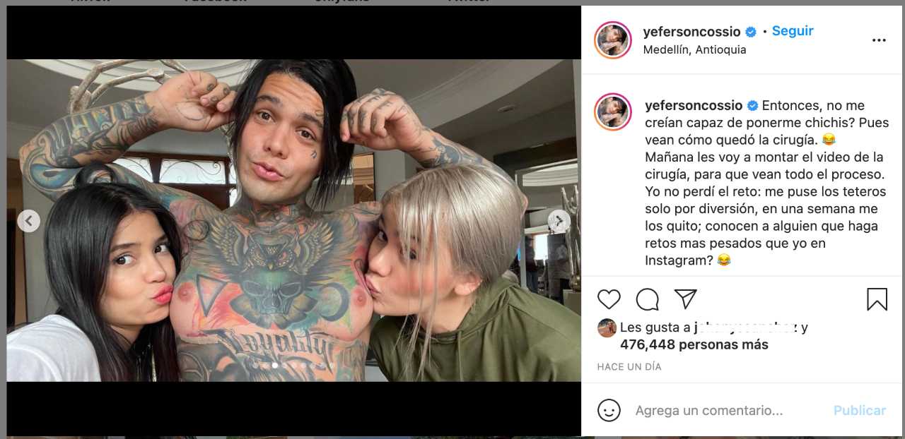 Yeferson Cossio muestra sus implantes
