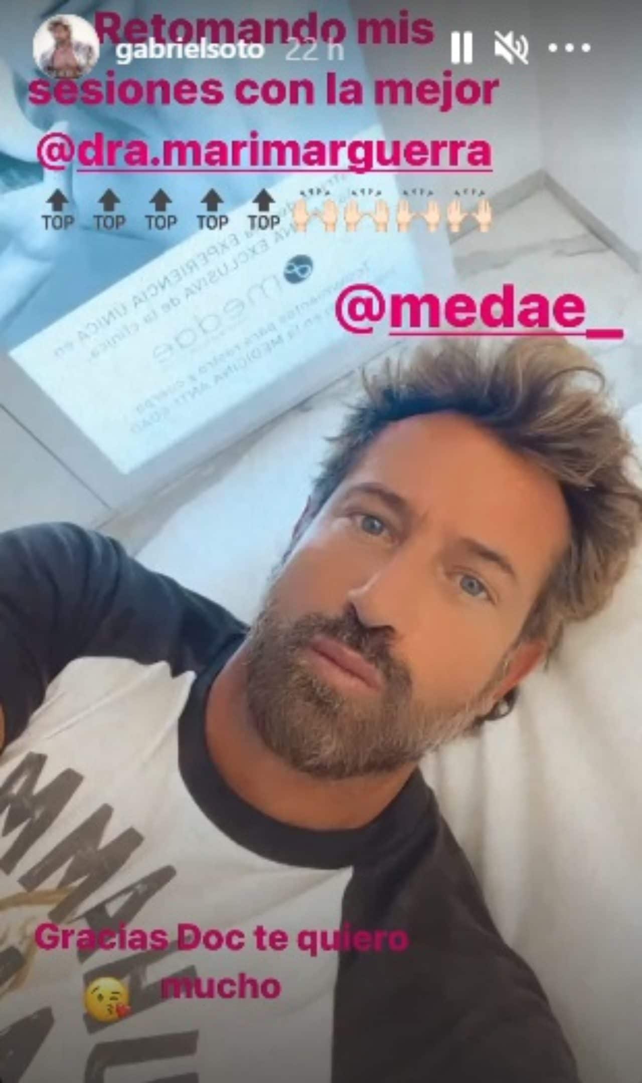 Gabriel Soto revela cómo cuida cara arrugas
