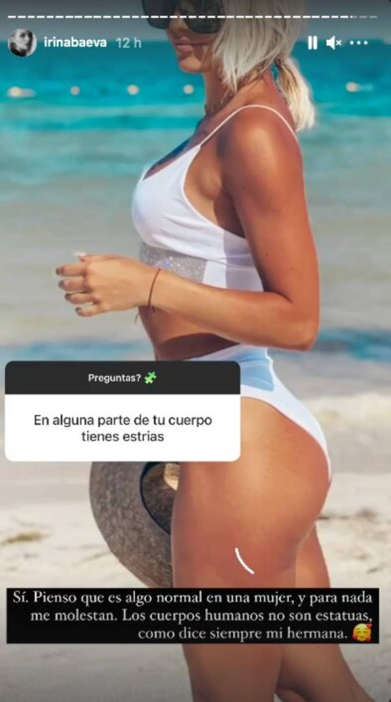 Irina Baeva estrías foto