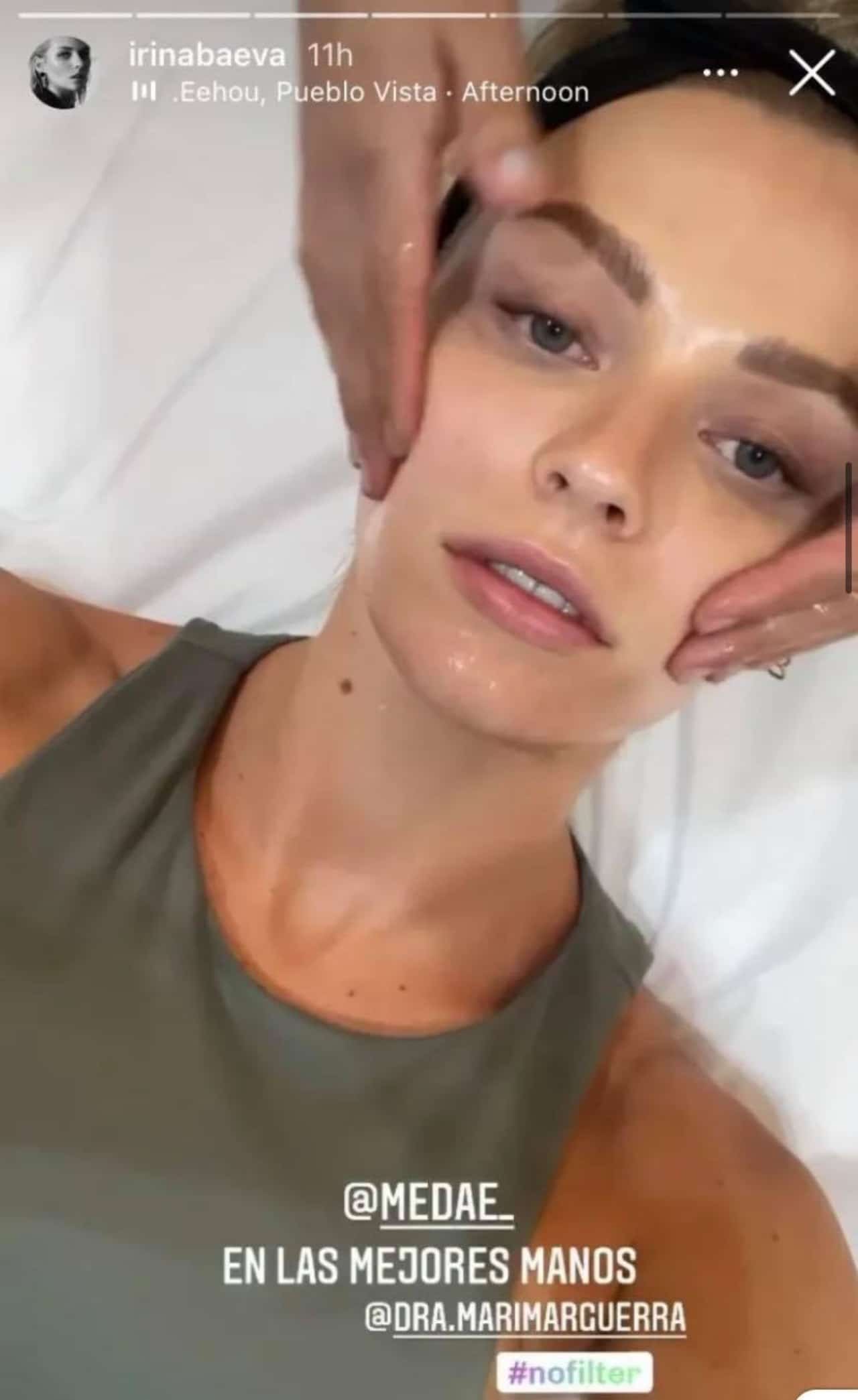 Irina baeva sin maquillaje tratamiento cara