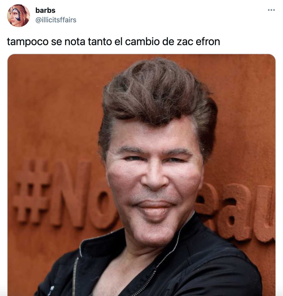 Zac quedó así con este meme