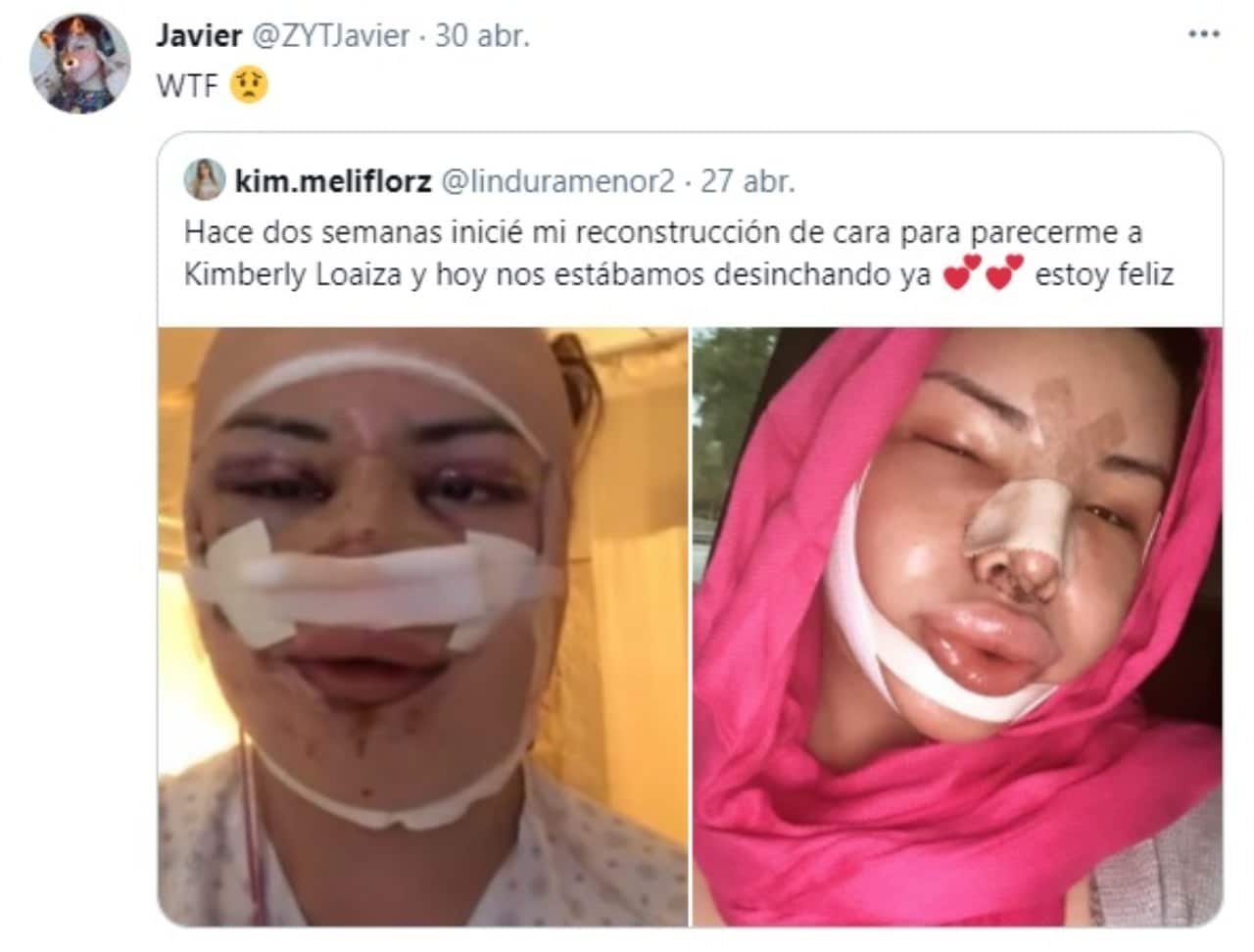 Youtuber se opera Kimberly Loaiza