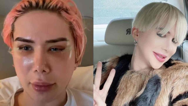 Influencer britÃ¡nico ahora se identifica como "coreano" tras 18 cirugÃ­as