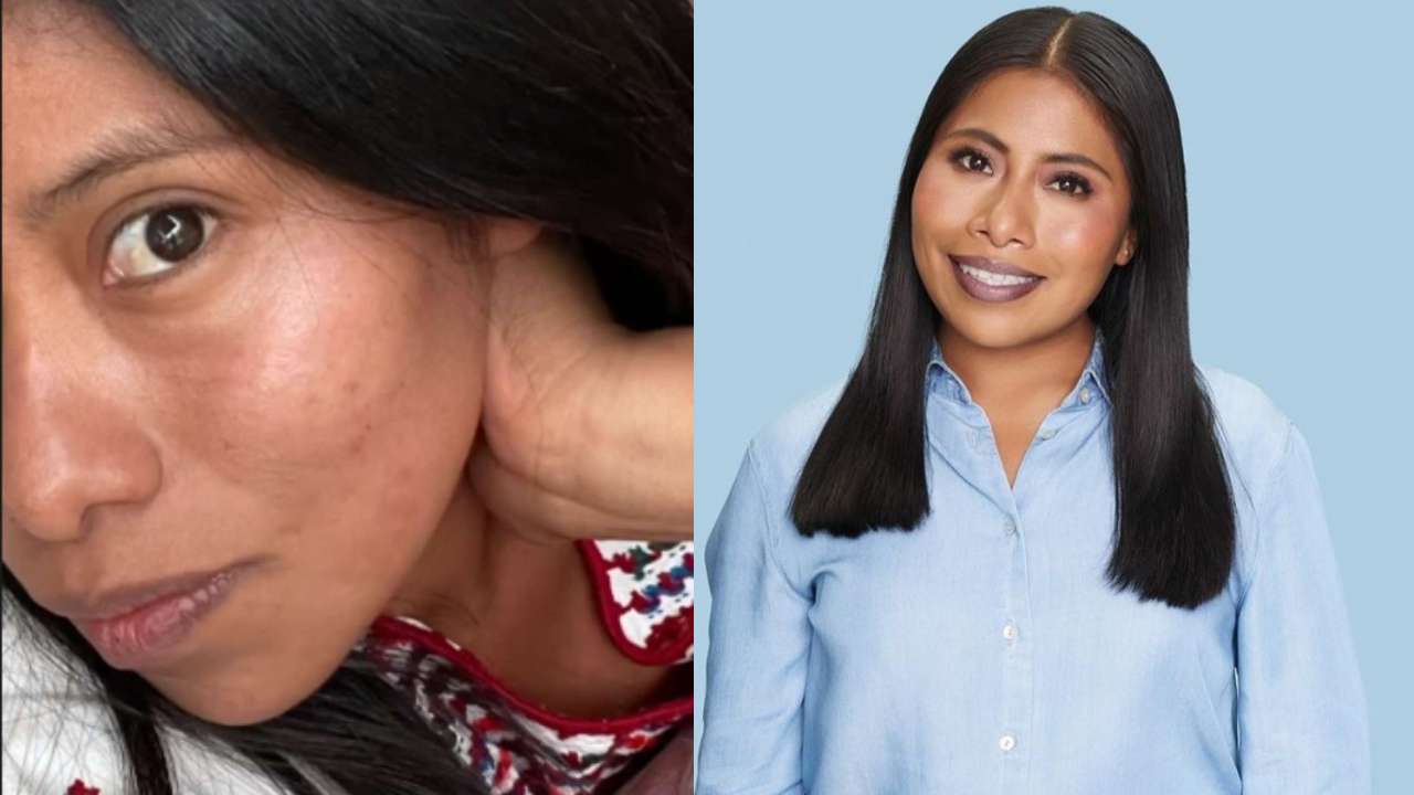 Yalitza Aparicio se muestra sin maquillaje y con manchitas