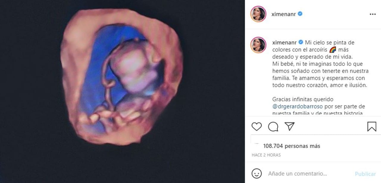 Ximena Navarrete anuncia que está embarazada