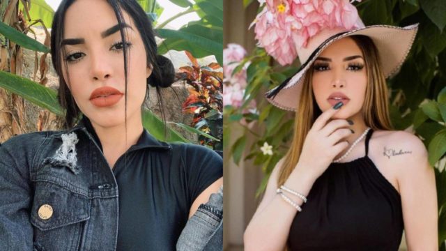 Kimberly Loaiza desata polÃ©mica por su Ãºltima cirugÃ­a: "era mÃ¡s linda antes"