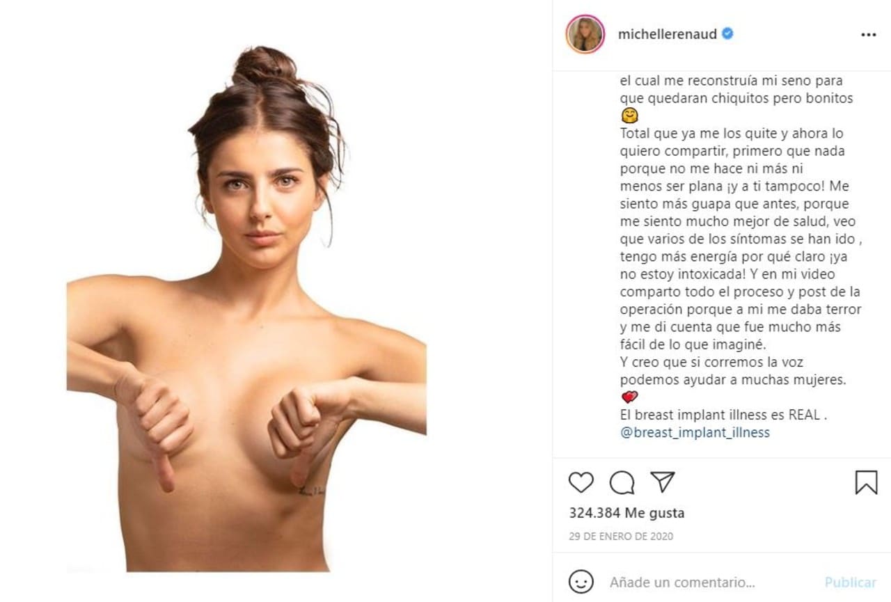 A Michelle Renaud se le abrieron las cirugías en plena escena