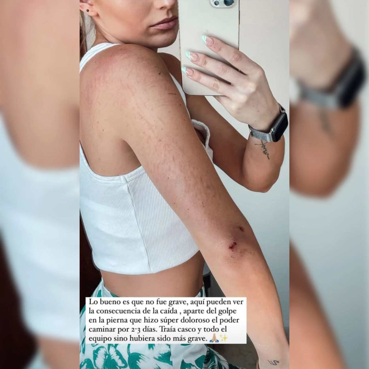 Irina Baeva accidente caballo