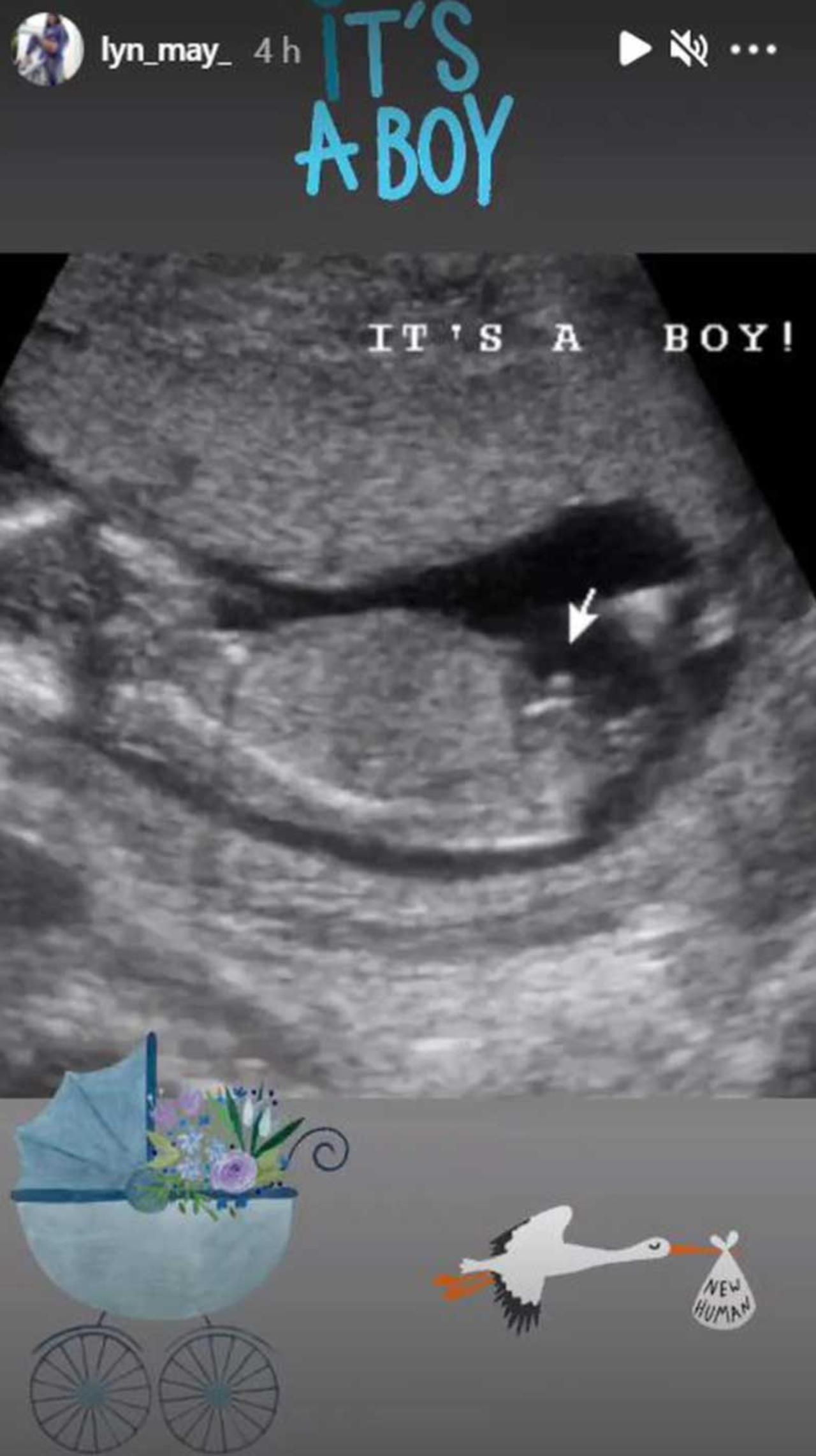 Lyn May ultrasonido de su bebe