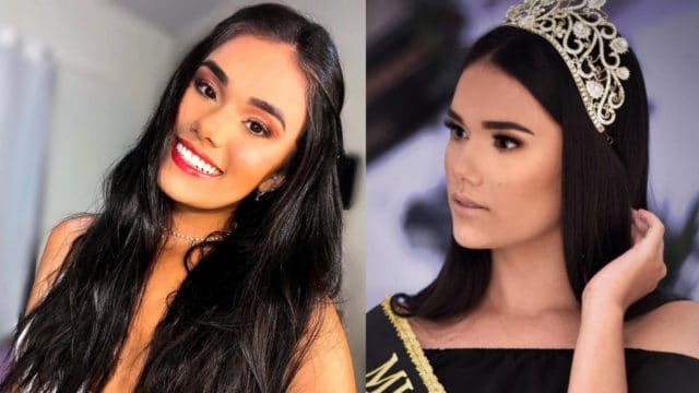 muere reina belleza en cirugia medica